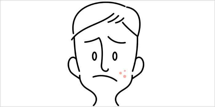 ニキビに悩む男性のイラスト