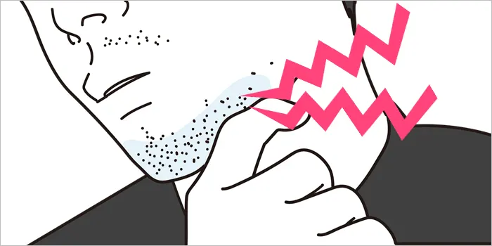 髭剃りの肌荒れでヒリヒリしている男性のイラスト